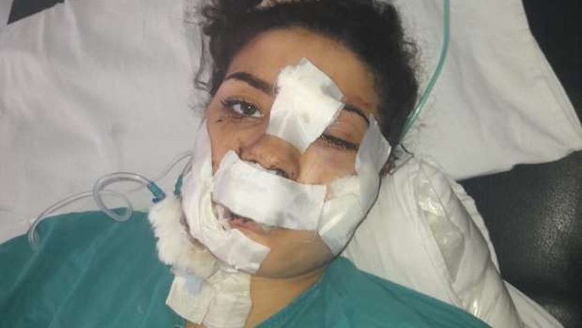الشابة المصرية إسراء عماد التي تعرضت لهجوم وحشي في الاسكندرية